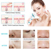 4 In 1 Ultrasonic USB Rechargeable Electric Facial